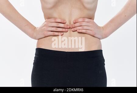 Rear view of the back of a thin woman showing the ribs and spine