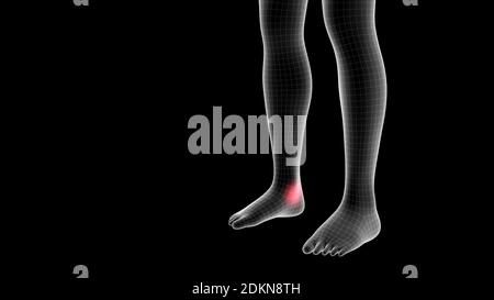 3d illustration of a woman xray hologram showing pain area on the leg area Stock Photo