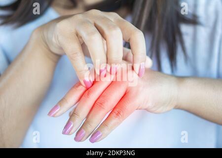 Woman scratching her body while having allergy to chemicals Stock 