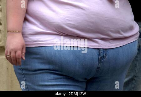 File photo dated 24/09/18 of an obese woman. Being overweight is more dangerous for men than women when it comes to developing bowel cancer, according to new research, but a bigger waist affects women more. Stock Photo