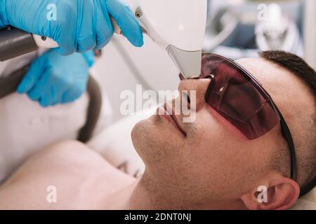 Cropped close up of a young man removing hair on his nose at beauty salon. Professional comsetologist using laser hair removal device on her male clie