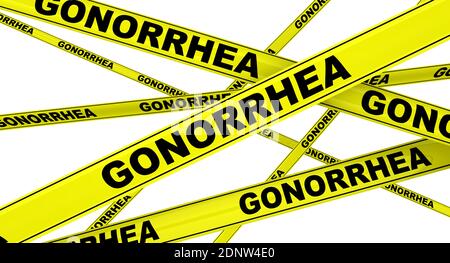 Gonorrhea. Yellow warning tapes with black words GONORRHEA (is a sexually transmitted infection caused by the bacterium Neisseria gonorrhoeae) Stock Photo