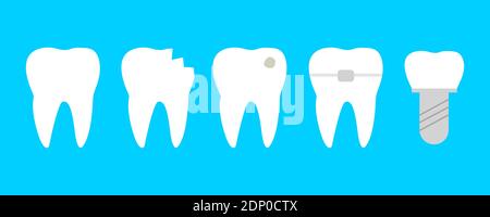 Teeth set with different diseases. Healthy tooth, cracked, brocken, with caries, orthodontic braces and dental implant Stock Vector