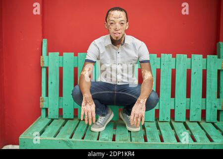 Young man with vitiligo on a green bench in front of a red wall Stock Photo