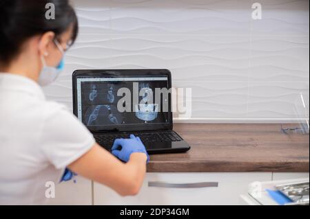 View from the back of a dentist examining an X-ray of a patient's jaw on a laptop Stock Photo