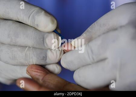 Health workers are testing blood of drivers from different commercial vehicles at a bus stand during a counselling and HIV test camp, organised by the Tripura State AIDS Control society.  Agartala, Tripura, India. Stock Photo