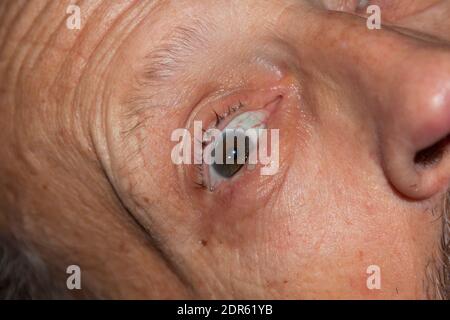 Anxious old man in the nursing home Stock Photo