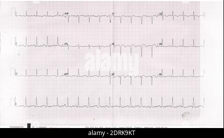 Close Up Of An ECG At Amsterdam The Netherlands 21-12-2020 Stock Photo