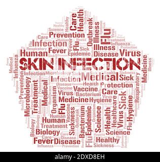 Skin Infection typography word cloud create with text only. Stock Photo