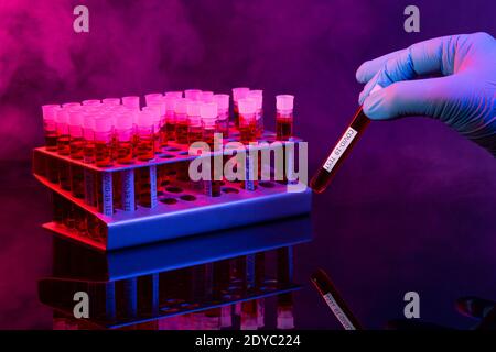 Test tubes to test for coronavirus infection. covid-19 and pandemic global concept . Stock Photo