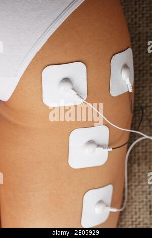 https://l450v.alamy.com/450v/2e05929/myostimulation-electrodes-on-the-buttocks-and-legs-of-a-woman-in-a-beauty-salon-rehabilitation-and-treatment-weight-loss-2e05929.jpg