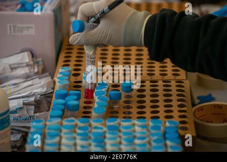 Test samples at a free Covid-19 testing camp at Anand vihar bus terminal.Delhi conducts random coronavirus testing at bus terminals, railway stations, outside metro stations, etc. Stock Photo