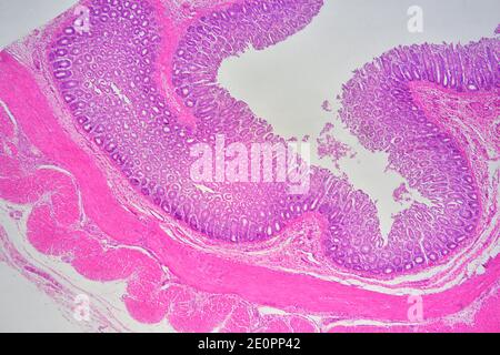 Rectum Large Intestine Showing Muscular Layer Lamina Propria