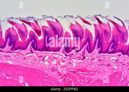 Tongue papilla. Light micrograph of a longitudinal section through a ...