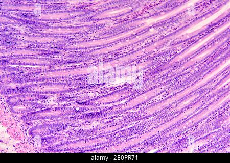 Human small intestine (ileum) showing mucosa with Lieberkhun crypts. X125 at 10 cm wide.