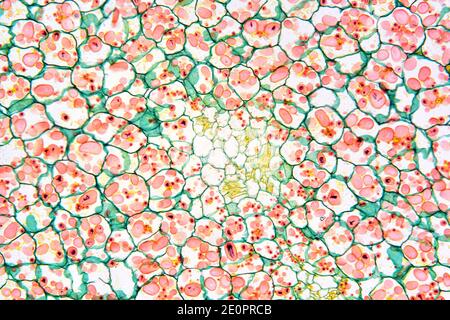 Amyloplasts on a potato tuber (Solanum tuberosum). Microphotograph X100 ...