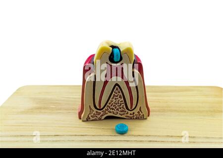 Big tooth dental caries model and candy on wooden  on white wooden background.Saved with clipping path Stock Photo