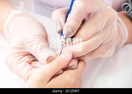 Hardware processing of the nail plate close-up Stock Photo
