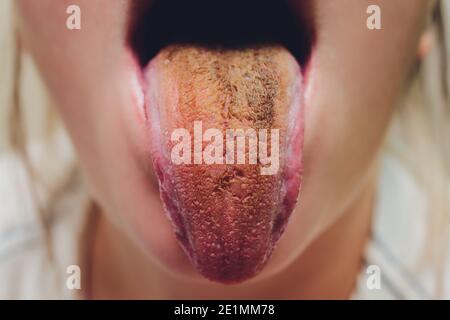 dirty tongue, close-up, dark brown after soda Stock Photo
