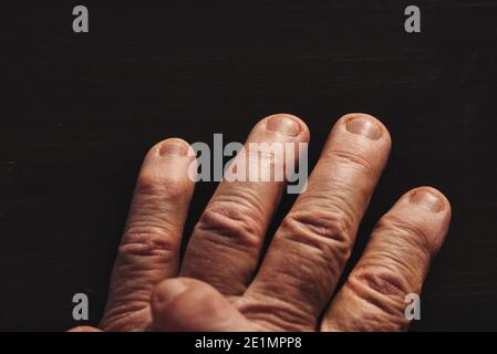 Fingers of old man on fingers. High angle view. Stock Photo