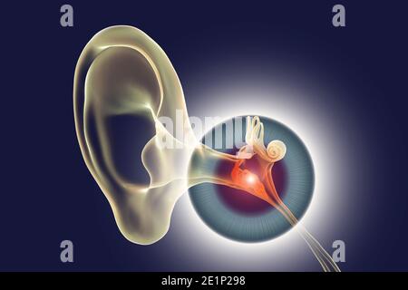 Otitis media ear infection, illustration Stock Photo