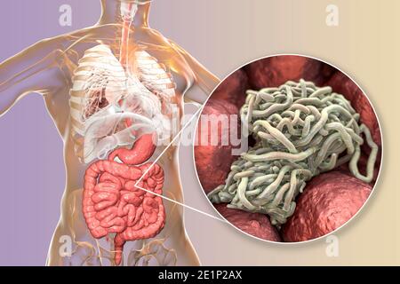 Round worms in human intestine, illustration Stock Photo