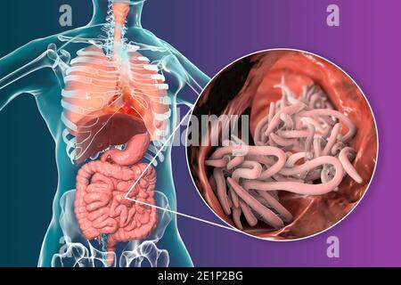 Round worms in human intestine, illustration Stock Photo