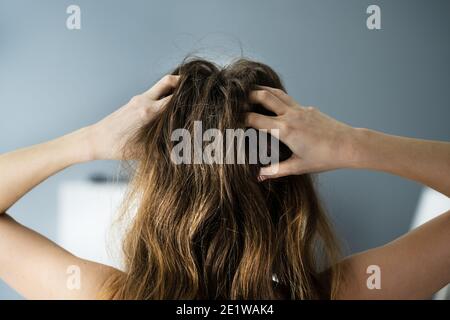 Itching Dry Head Scalp And Long Hair With Dandruff Stock Photo - Alamy