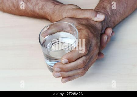 The hands of a man with Parkinson's disease tremble. Strongly trembling hands of an older man Stock Photo