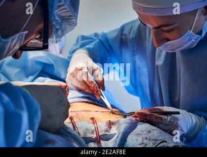 Close up of surgical team in sterile gloves stitching up wound after tummy tuck surgery. Plastic surgeon and assistant placing sutures after abdominal plastic surgery in operating room. Stock Photo