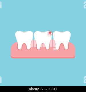 Tooth with ache pain and healthy in gum isolated. Stock Vector