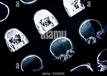 Ct-scan of the human head for medical or scientific background Stock Photo