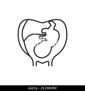 Pregnancy stage embryo in uterus with umbilical cord black line icon. Growth fetus development. Pictogram for web page, mobile app. UI UX GUI design e Stock Vector