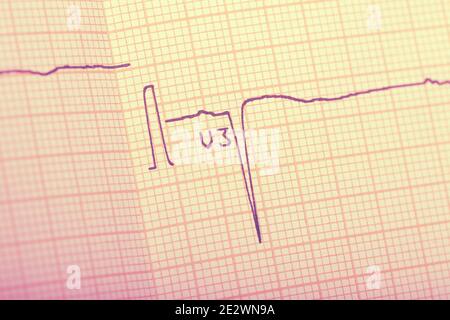 ECG result on paper closeup. Stock Photo