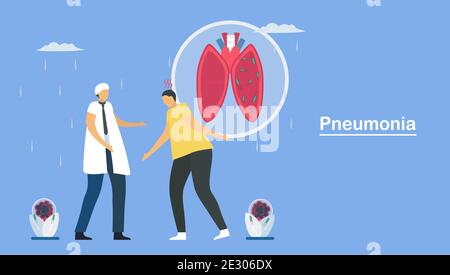 Pneumonia is infection that inflames air sacs in one or both lungs. This symptom is caused by bacteria, viruses and fungi. Pulmonology vector illustra Stock Vector