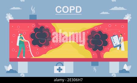 Chronic obstructive pulmonary disease or COPD. Lung have breathing problems and poor airflow. To clean alveoli in blood vessel. Vector illustration in Stock Vector