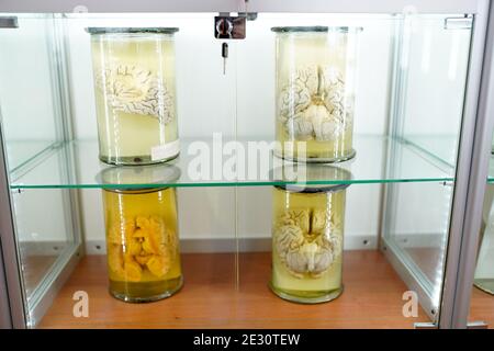 human brain on light background. part of body in formalin . Medical clinic concept. science museum . Stock Photo