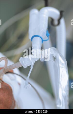 Lung ventilation equipment of the patient. Stock Photo