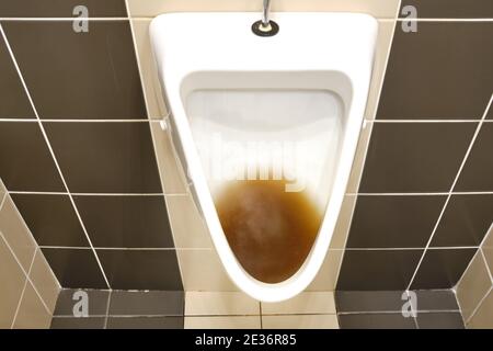 https://l450v.alamy.com/450v/2e36r85/dirty-clogged-urinal-with-water-in-the-toilet-of-a-restaurant-disinfection-and-hygiene-in-toilets-of-public-buildings-2e36r85.jpg