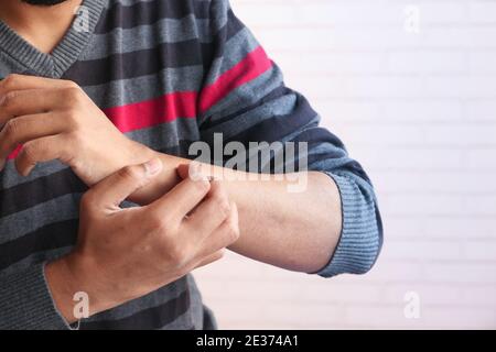 young man's hand suffering from itching skin Stock Photo