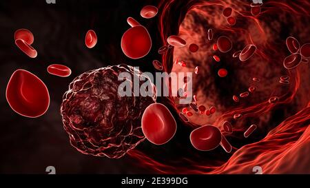 Cancer cell or cancerous tumor amidst flowing red blood cells in a blood vessel, artery or vein 3D rendering illustration. Medicine, pathology, oncolo Stock Photo