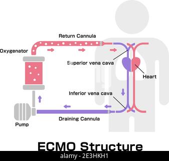 ECMO ( Extracorporeal membrane oxygenation ) structure vector illustration Stock Vector