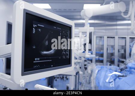 Ultrasound diagnostic methods in modern advanced medical practice. Screen of an echocardiogram machine in the operating room.
