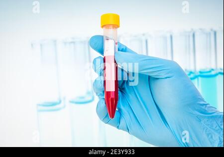 Scientists hand holding a test-tube with blood sample for blank label Stock Photo