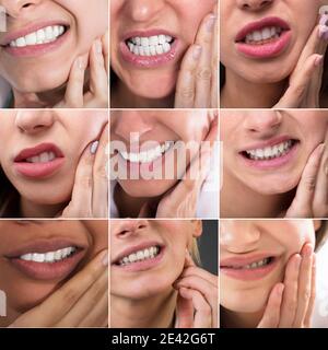 Tooth Decay Pain. Sore Mouth. Dental Ache Collage Stock Photo