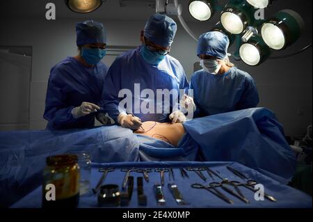 Group of doctors in sterile gloves and protective face masks doing cosmetic surgery in operating room at hospital. Patient with marks on belly lying on operating table. Concept of plastic surgery. Stock Photo