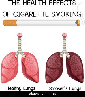 An Education Poster of Smoking and Health illustration Stock Vector ...