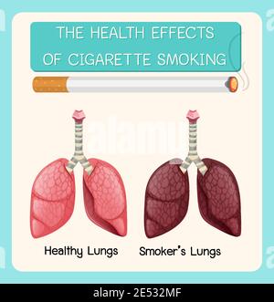 An Education Poster of Smoking and Health illustration Stock Vector ...