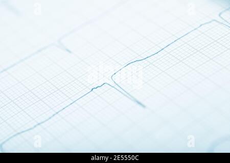 Curve line on the graph paper. Stock Photo