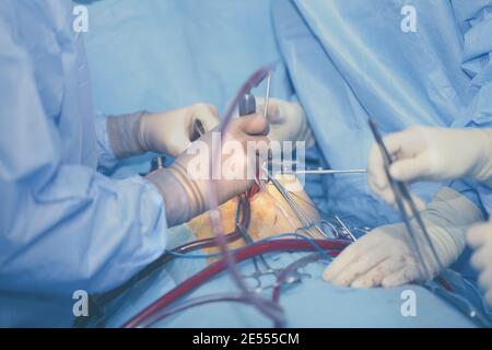 Surgeon's work in the operating theatre. Stock Photo